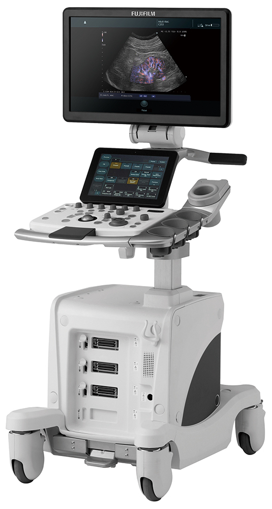超音波検査機器
